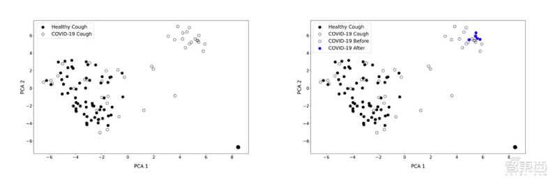 新冠病毒还能用语音识别？AI模型“听”咳嗽声判断是否感染